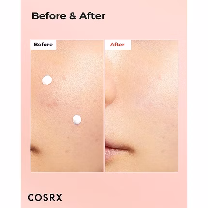 COSRX AC Collection Blemish Spot Drying Lotion 30 ml COSRX AC Collection Blemish Spot Drying Lotion 30 ml